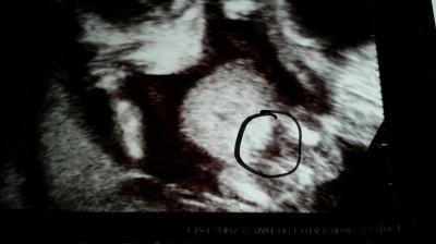 Bild zu Geschlecht?! - Forum für November - Mamis