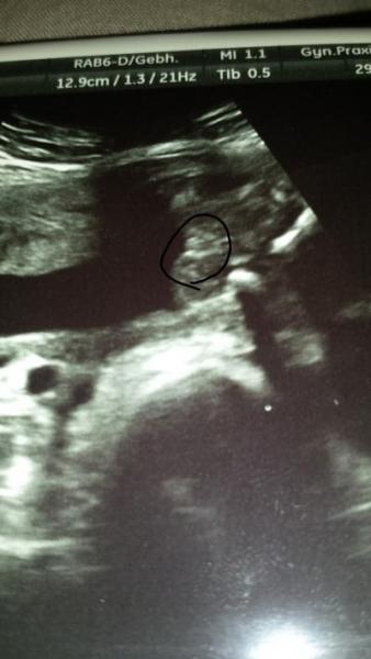 Bild zu Junge oder Mädchen? - Forum für November - Mamis