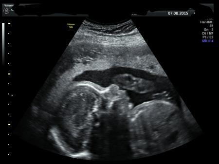 Bild zu Zurück aus Italien, Ergebnisse FA-Termin und Uhu :-) - Forum für November - Mamis