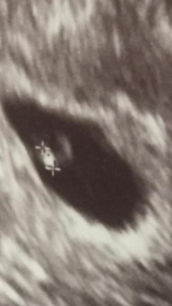 Bild zu Schwarzer Punkt im Baby - Forum für November - Mamis