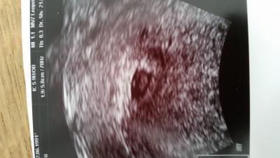Bild zu Zurück vom FA..... - Forum für November - Mamis