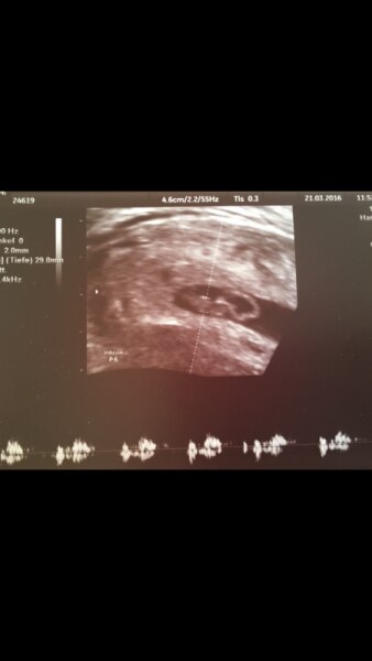 Bild zu Ein kleines Bild für euch - Forum für November - Mamis