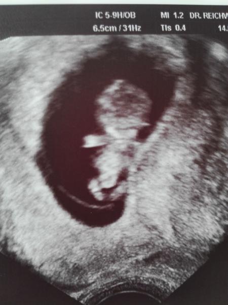 Bild zu Wieder da.. - Forum für November - Mamis