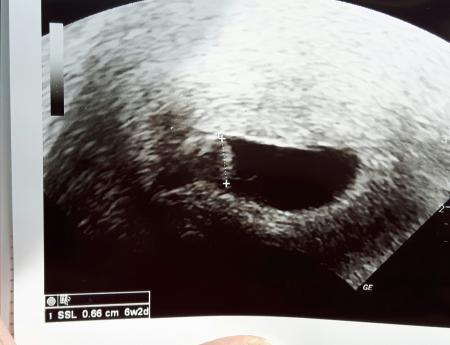 Bild zu Zurück vom Fa - Forum für November - Mamis