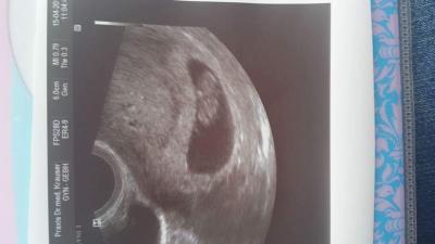 Bild zu Auch wieder da - Forum für November - Mamis