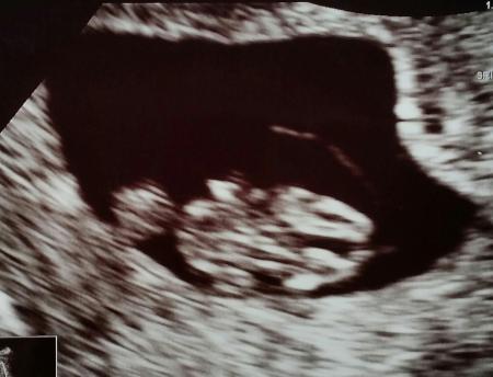 Bild zu Von der Quappe zum Frosch! - Forum für November - Mamis