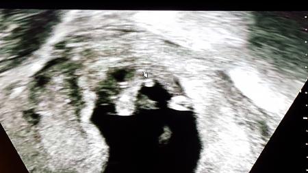 Bild zu zurück vom FA :))))))) mit Outing - Forum für November - Mamis