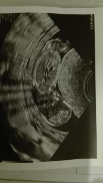 Bild zu Baby Bildchen !! :-) - Forum für November - Mamis