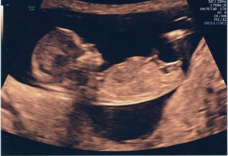 Bild zu Auch mal wieder melden... - Forum für November - Mamis