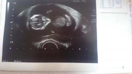 Bild zu hier die versprochen Bilder - Forum für November - Mamis