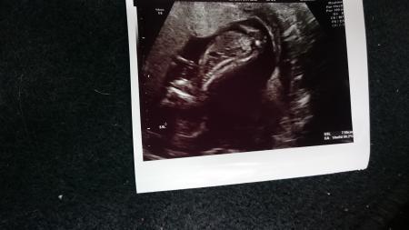Bild zu Freude über heute... Teil 2 - Forum für November - Mamis