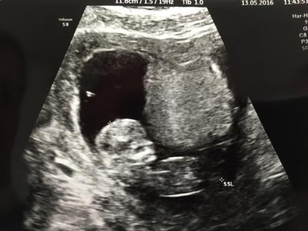 Bild zu Nur Bild - Forum für November - Mamis
