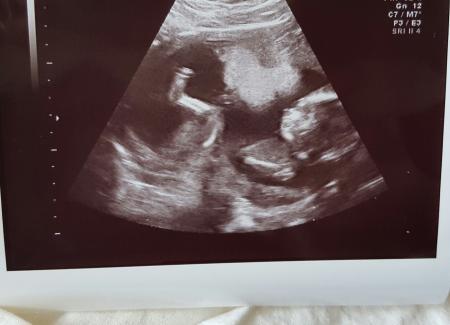 Bild zu Zurück vom FA - Forum für November - Mamis