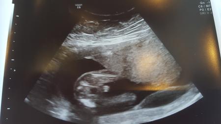 Bild zu FA Termin - Forum für November - Mamis