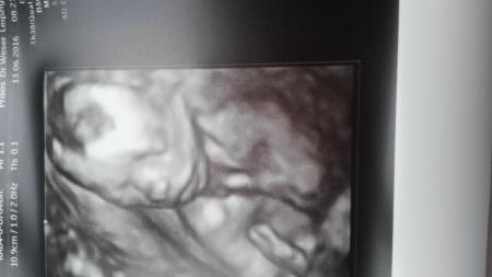 Bild zu Wieder da... - Forum für November - Mamis