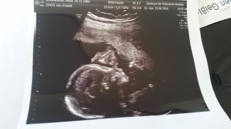 Bild zu Zurück von der Feindiagnostik - Forum für November - Mamis