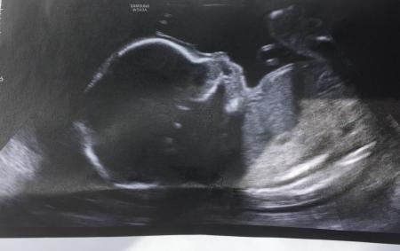 Bild zu Ich war auch beim Organ-US - Forum für November - Mamis