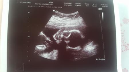 Bild zu Auch zurück vom Organ-US - Forum für November - Mamis