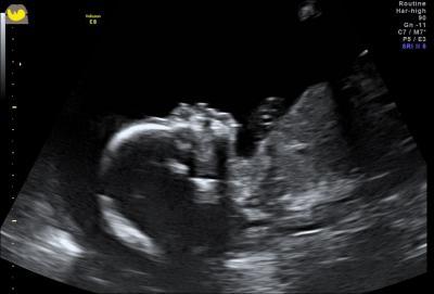 Bild zu Babyfoto - Forum für November - Mamis