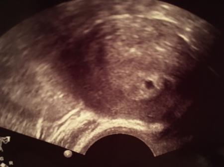 Bild zu Wo sind denn alle die heute auch Termin beim FA hatten? Ultraschallbilder? :) - Forum für November - Mamis