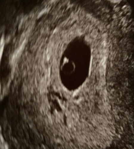 Bild zu hello baby - Forum für November - Mamis