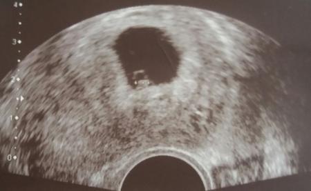 Bild zu Bin zurück.... - Forum für November - Mamis