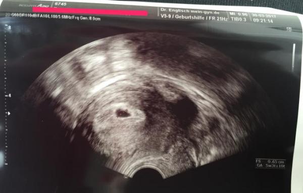 Bild zu Ungutes Gefühl - Forum für November - Mamis