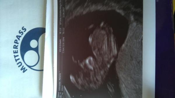 Bild zu Unser Hüpfer :) - Forum für November - Mamis