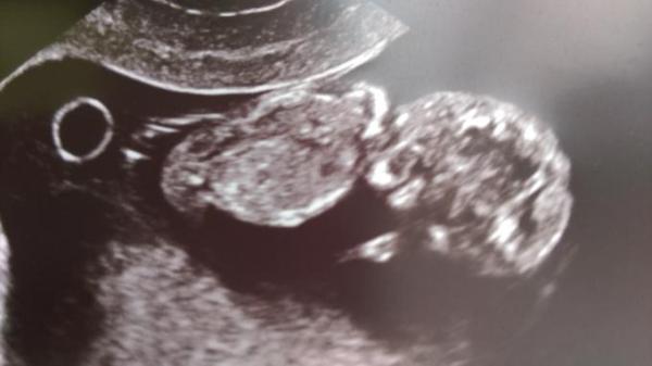 Bild zu hello baby, again :-) - Forum für November - Mamis