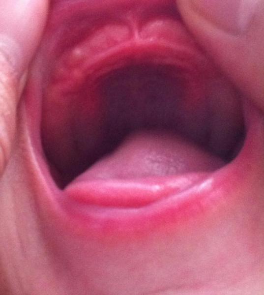 Bild zu