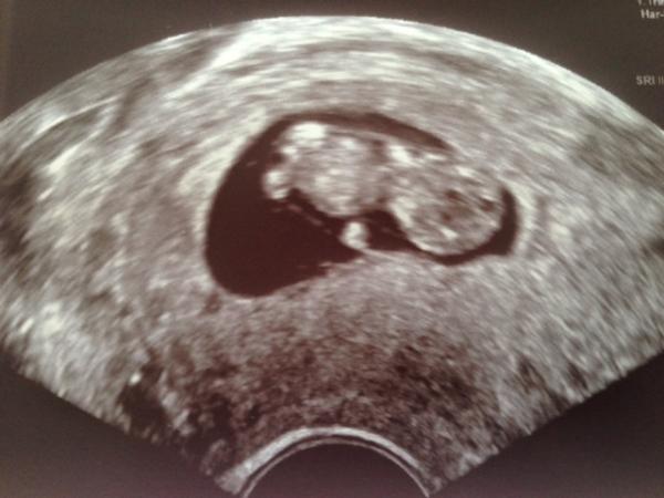 Bild zu ich bin so überglücklich - Forum für November - Mamis