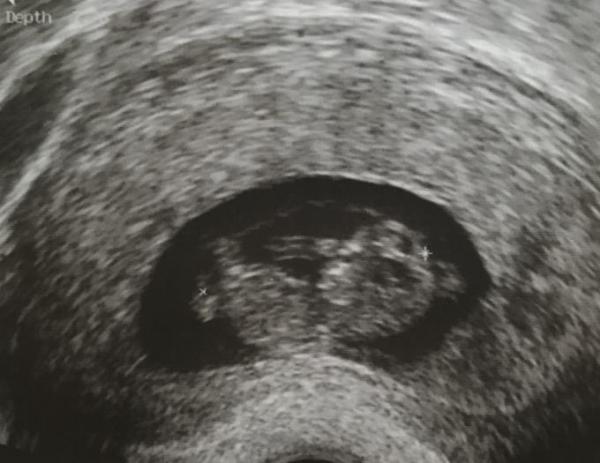 Bild zu Zurück vom FA... - Forum für November - Mamis