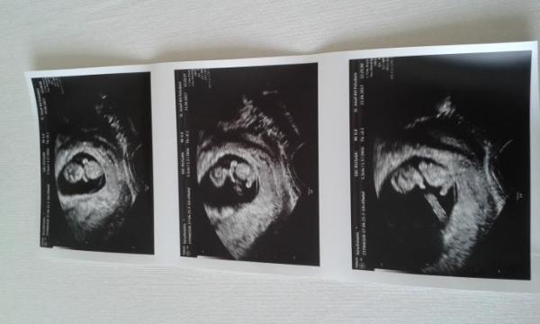 Bild zu Ich möchte Euch meinen Zwerg vorstellen - Forum für November - Mamis