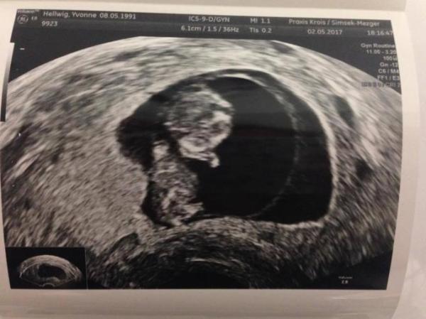 Bild zu Wir sagen mal wieder  - Forum für November - Mamis