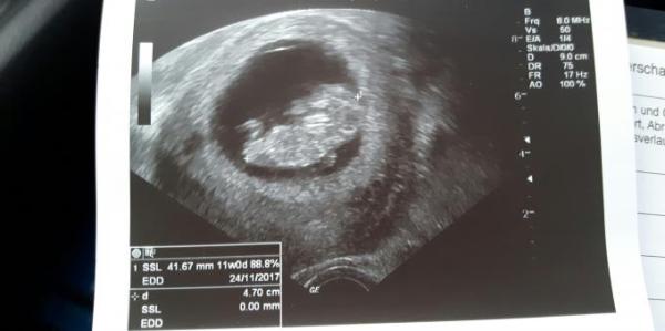 Bild zu Zurück vom Arzt... - Forum für November - Mamis