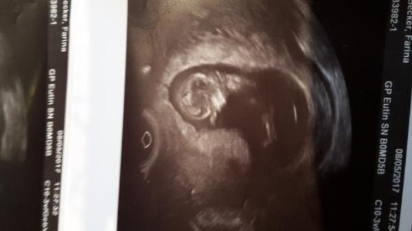 Bild zu Arztbesuch heute - Forum für November - Mamis
