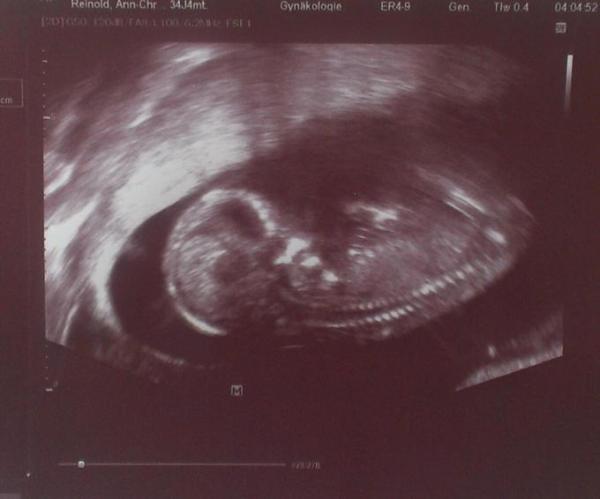 Bild zu Ebenfalls beim Arzt gewesen - Foto - Forum für November - Mamis