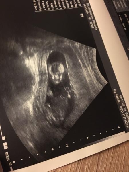 Bild zu Könnte das ein Mädchen oder Junge sein? - Forum für November - Mamis