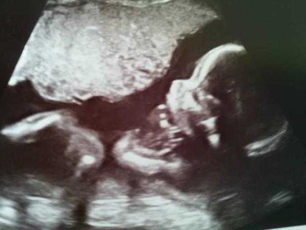 Bild zu Baby TV - Forum für November - Mamis
