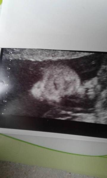 Bild zu Mal wieder melden - Forum für November - Mamis