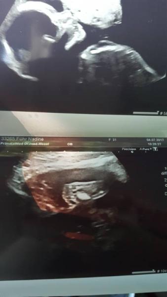 Bild zu Zurück vom Arzt - Forum für November - Mamis