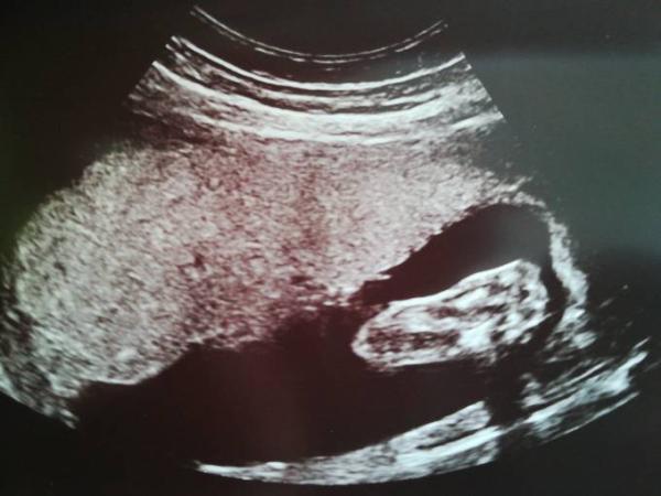 Bild zu Update Baby Boy 😍 - Forum für November - Mamis