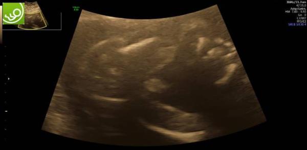 Bild zu Wieder zurück vom Prenatalzentrum - Forum für November - Mamis