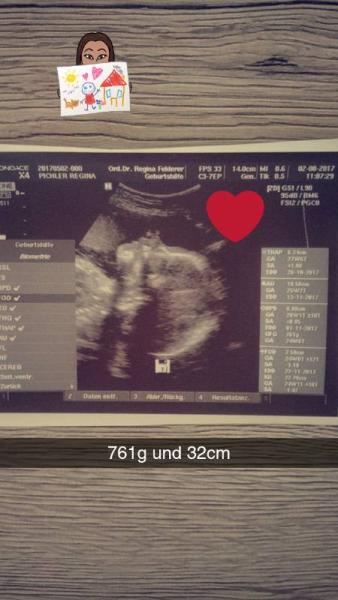 Bild zu heute Termin gehabt - Forum für November - Mamis