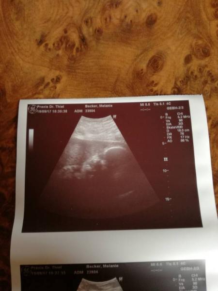 Bild zu Gestern FA Termin gehabt - Forum für November - Mamis