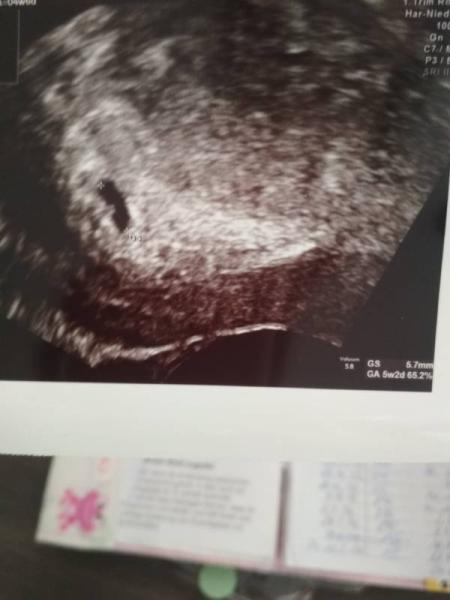 Bild zu Erstes Bild - Forum für November - Mamis
