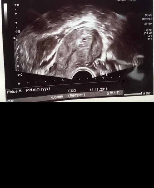 Bild zu Zurück vom Gyn 😍 - Forum für November - Mamis
