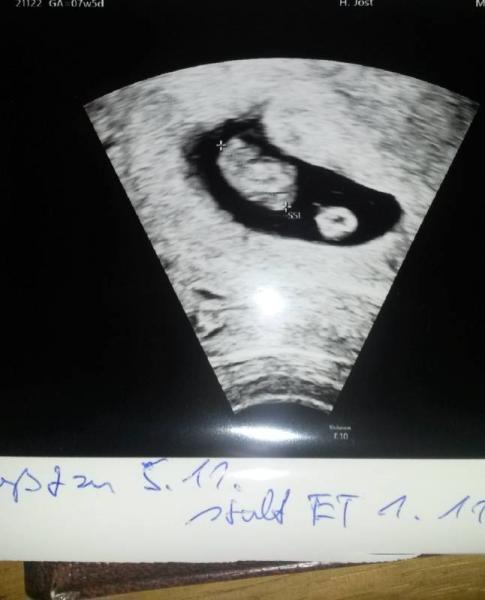 Bild zu Endlich!!! - Forum für November - Mamis