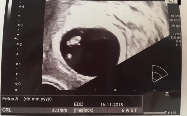 Bild zu Zurück vom Doc - Forum für November - Mamis