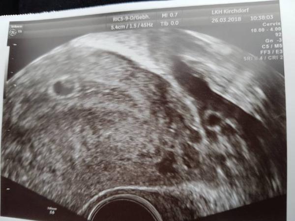 Bild zu So schöön! - Forum für November - Mamis